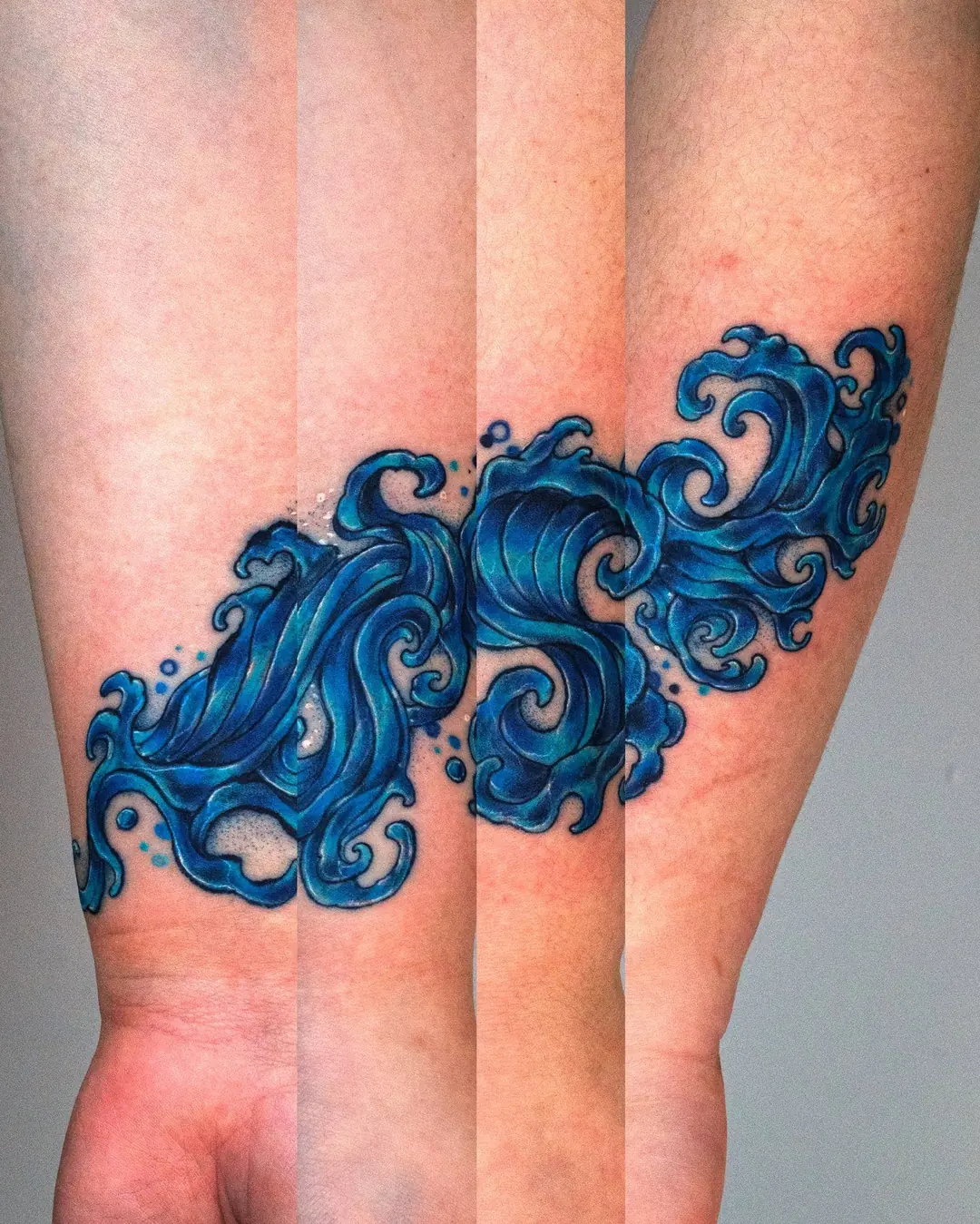 Wave pattern, Forearm